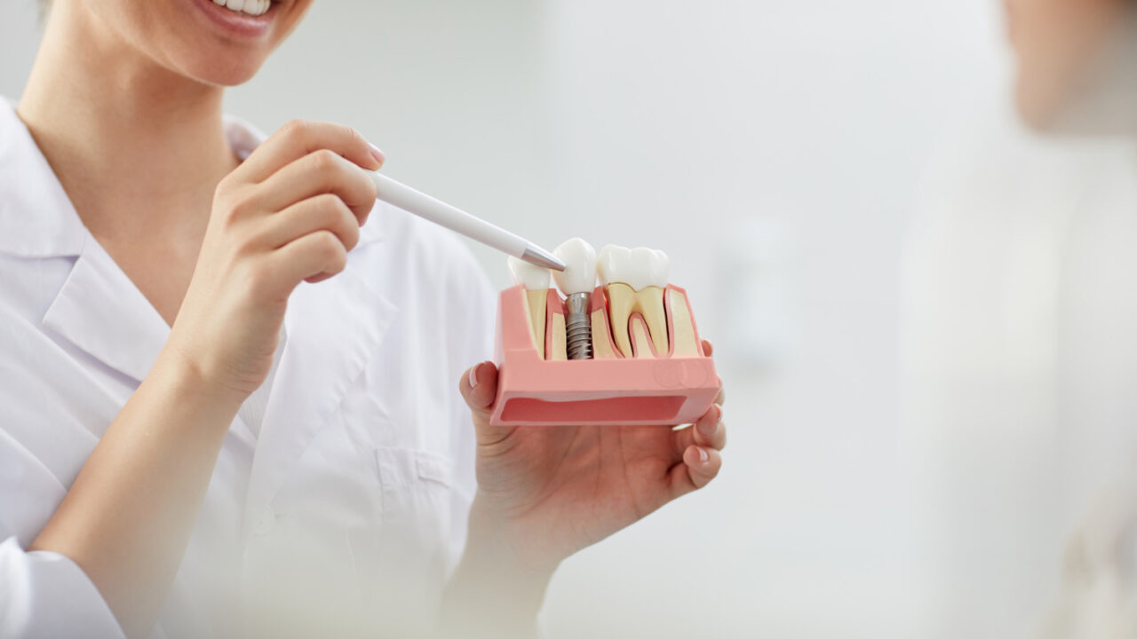 smiling-dentist-explaining-tooth-implantation