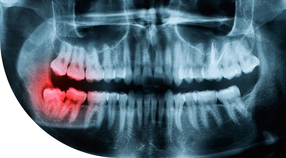 1000093089 1 (5) https://babic-dent.com/wp-content/uploads/2025/07/1000093089-1-5.png